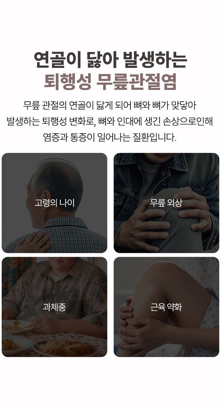 무릎관절염 진행단계, 의심단계, 경증단계, 중간단계, 중증단계