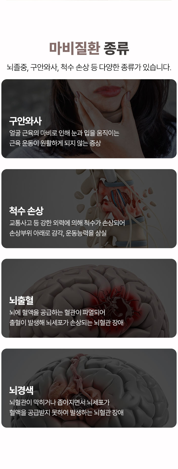 마비질환 종류, 구안와사, 척수 손상, 뇌출혈, 뇌경색